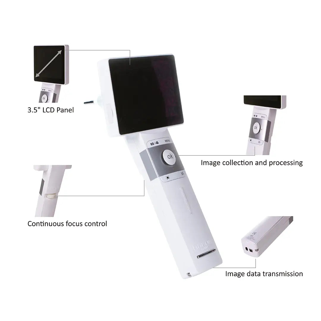 ENT Digital Otoscope With Video Camera for clinic