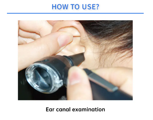 Portable LED Medical ENT Diagnostic Ear Otoscopic Auriscope Ear Otoscope