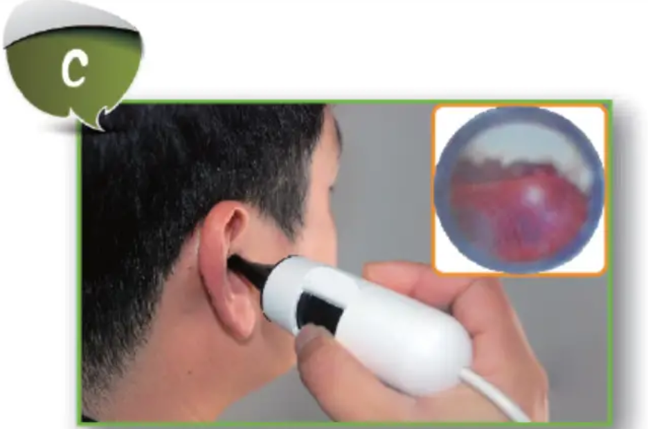 Dino Digital Video Otoscope AM311HT