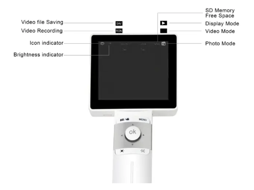 ENT Digital Otoscope With Video Camera for clinic
